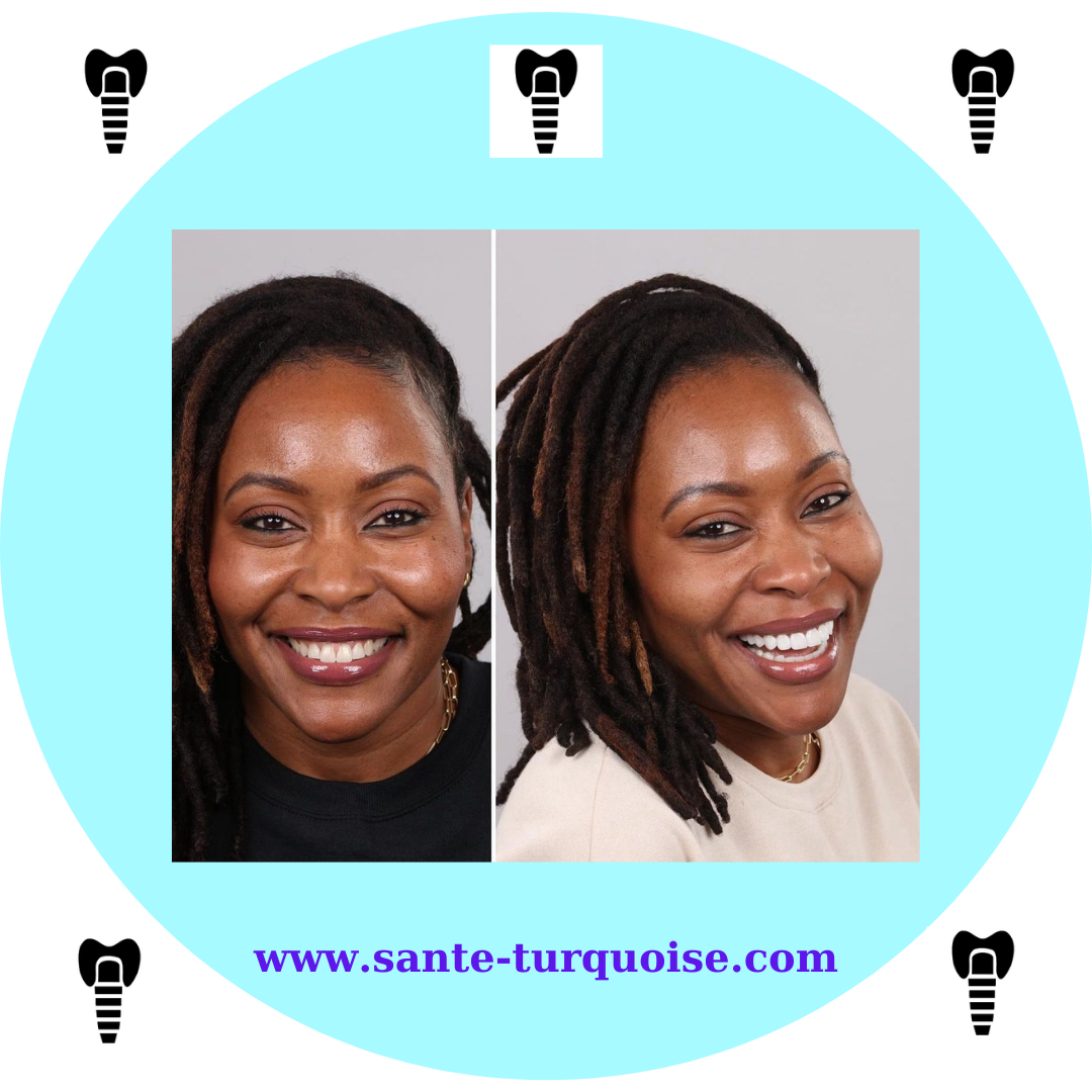 Upgrade your smile, upgrade your life.