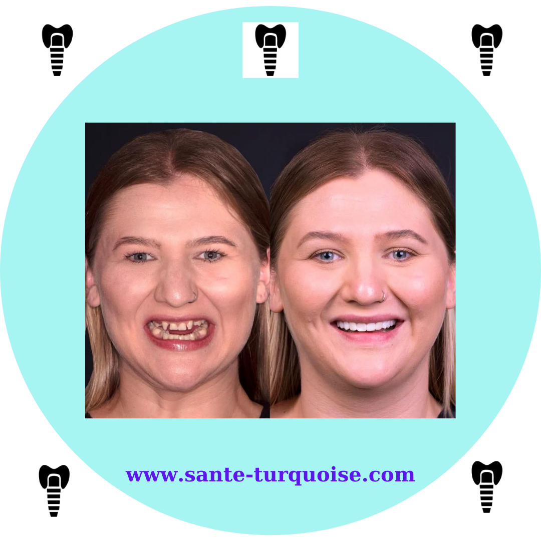 A new smile is the best investment.