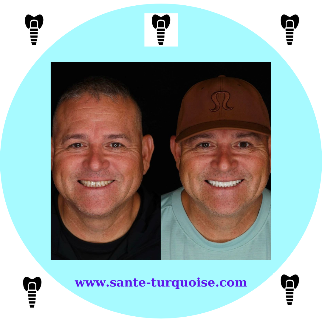 A healthy smile is a confident smile.