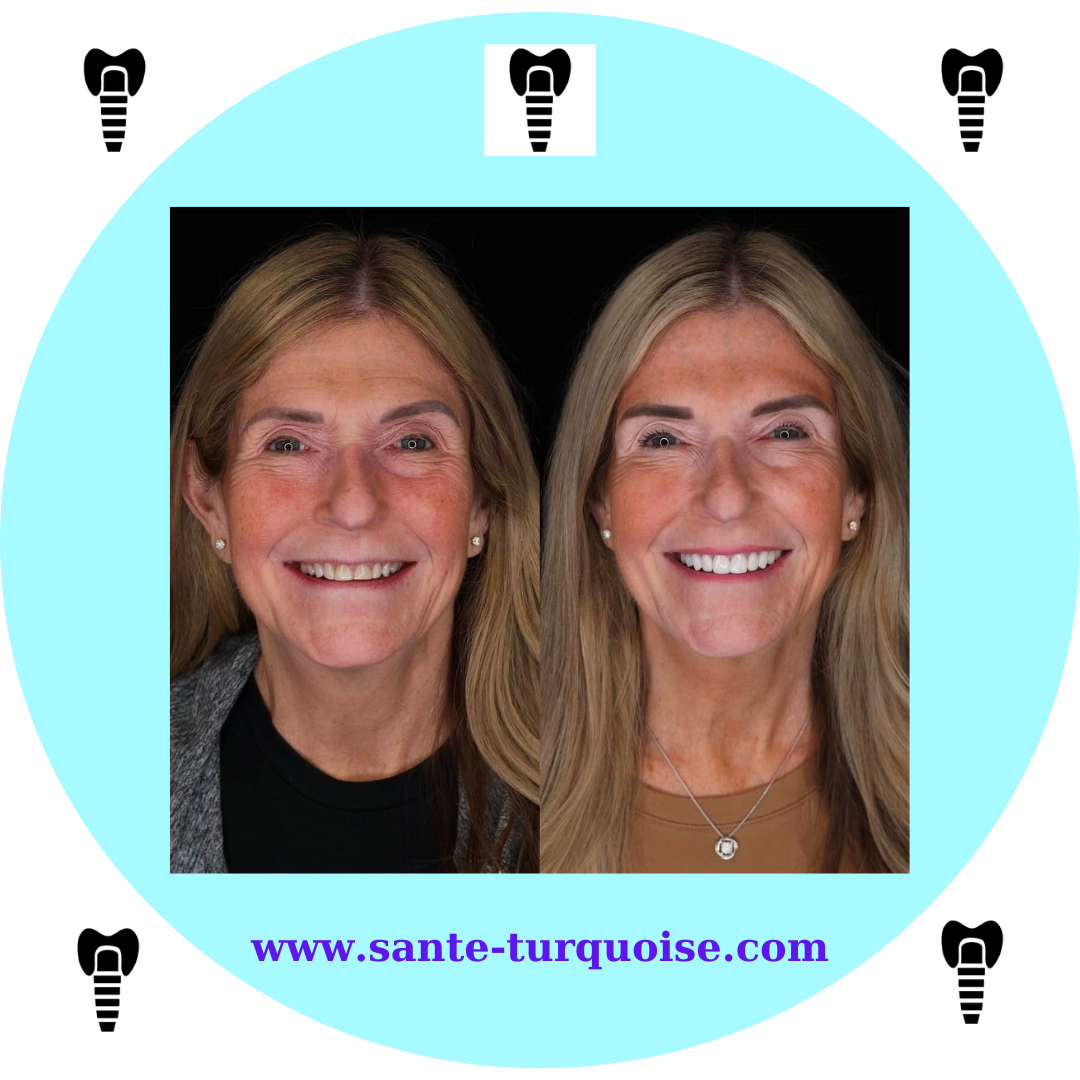 Istanbul Turkuaz Clinic — the destination for perfect smiles.