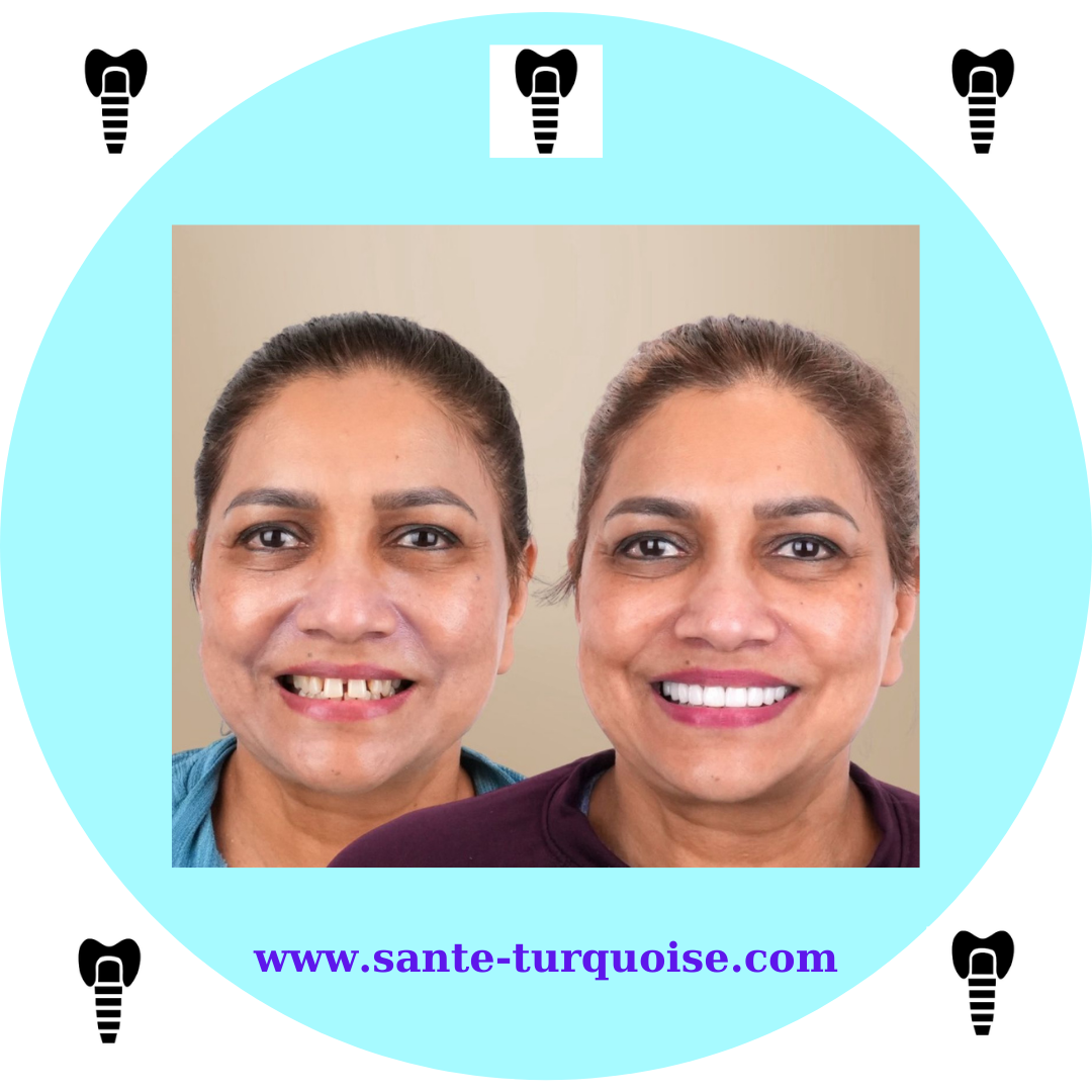 Dental art: where function meets beauty.