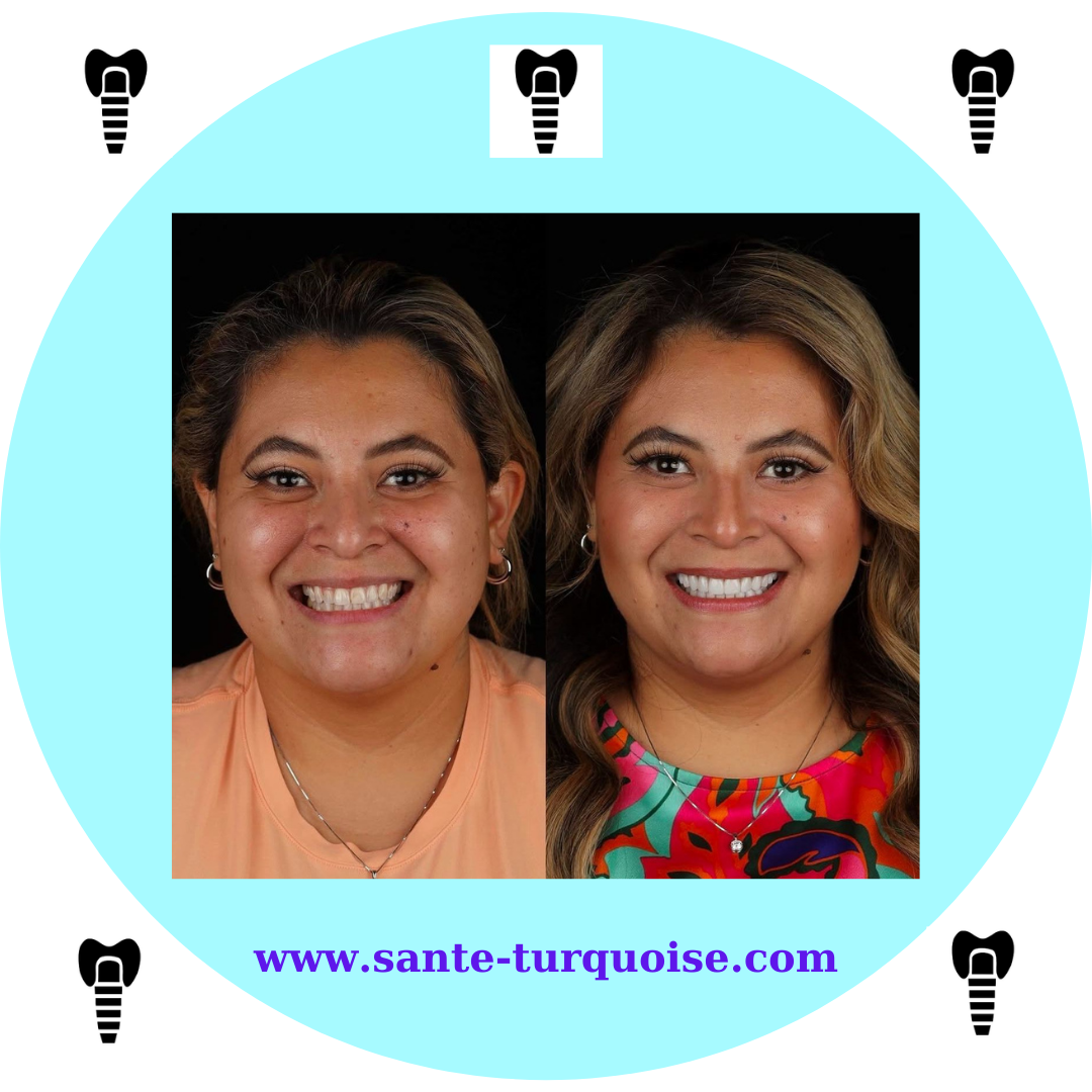 Smile more, worry less.