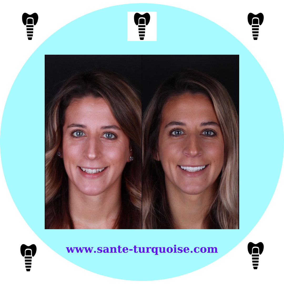 From missing to mesmerizing — hello new teeth.