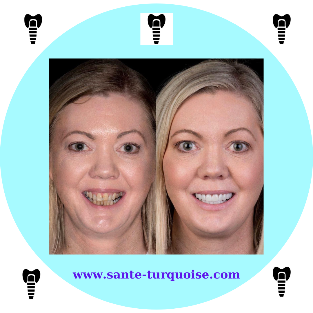 Every smile tells a success story.