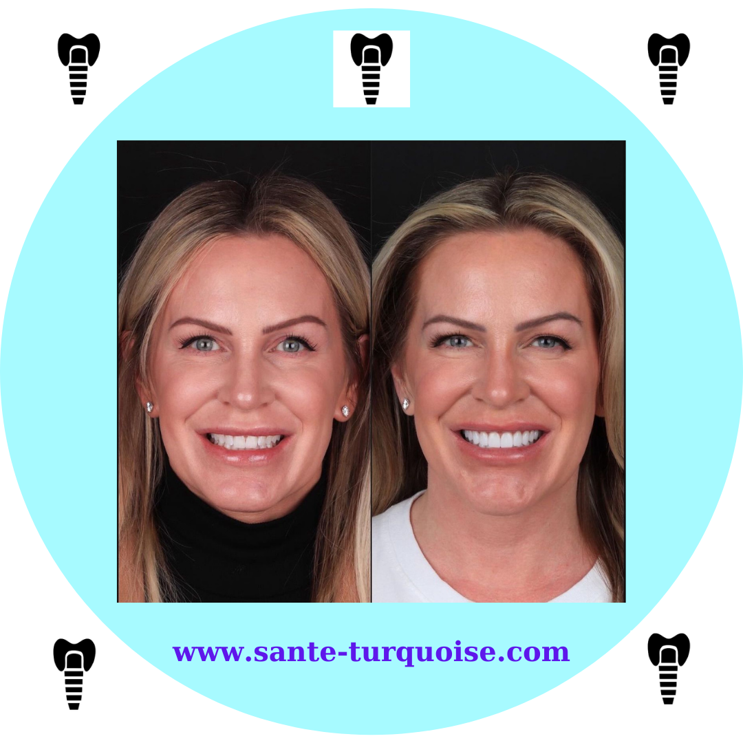 Dental implants = confidence restored.